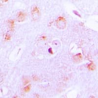 CYP17 / CYP17A1 Antibody (Internal)