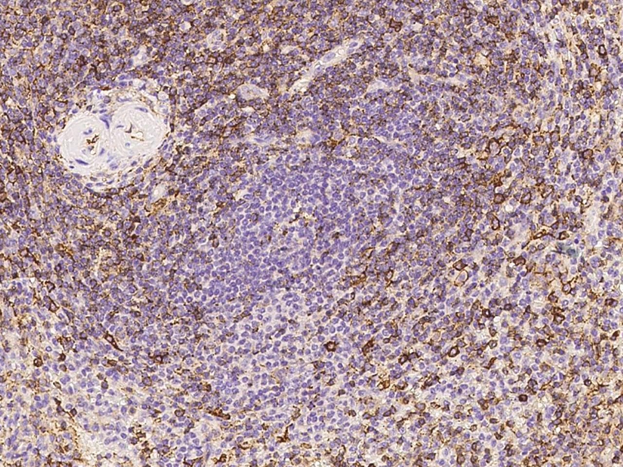SELPLG / PSGL-1 / CD162 Antibody (Preservative Free)