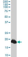 IHC-plus™ CLDN1 / Claudin 1 Antibody (clone 1C5-D9)