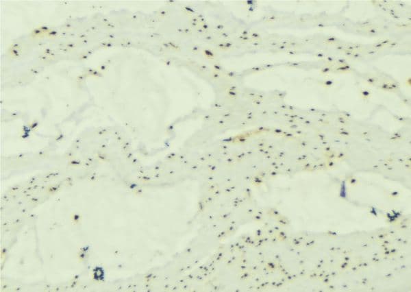 SNCG / Gamma-Synuclein Antibody