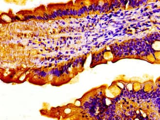 Polyclonal Rabbit anti-Human ACADVL Antibody (IHC, IF, WB)