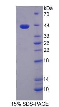 Human HDAC9 Protein (Recombinant His-T7)