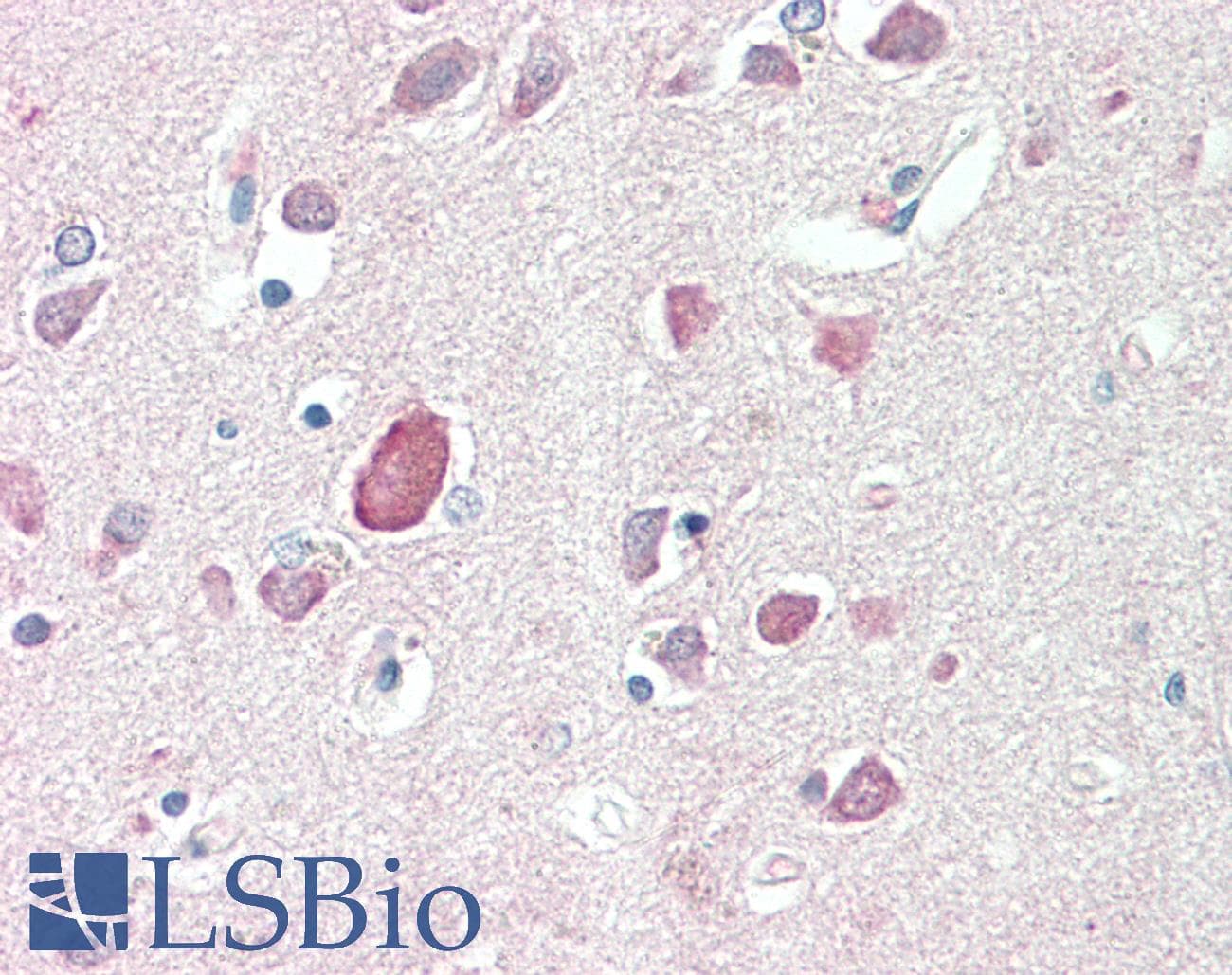 IHC-plus™ Prostaglandin D Synthase Antibody (aa27-38)