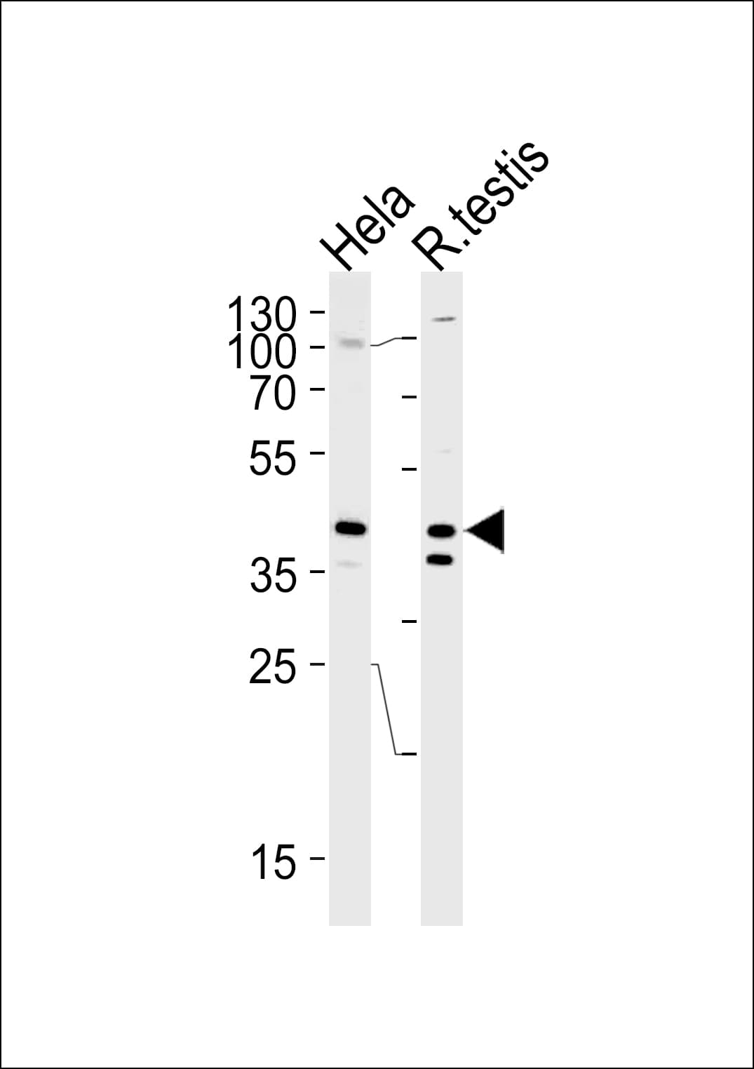 KHDRBS2 / SLM-1 Antibody (aa298-321)