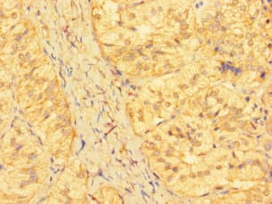 KRTAP23-1 Antibody