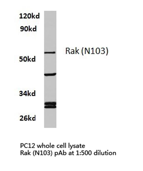 FRK Antibody (Asn103)
