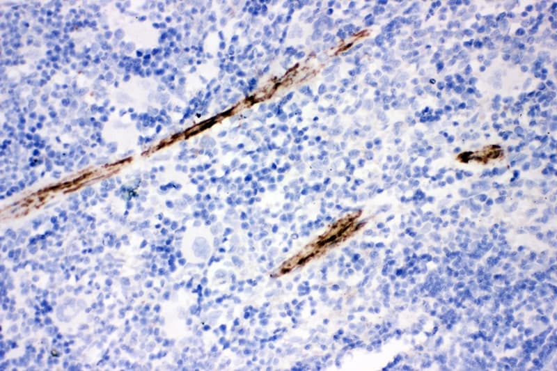 Polyclonal Rabbit anti-Human CNN1 / Calponin Antibody (aa283-297, IHC, WB)