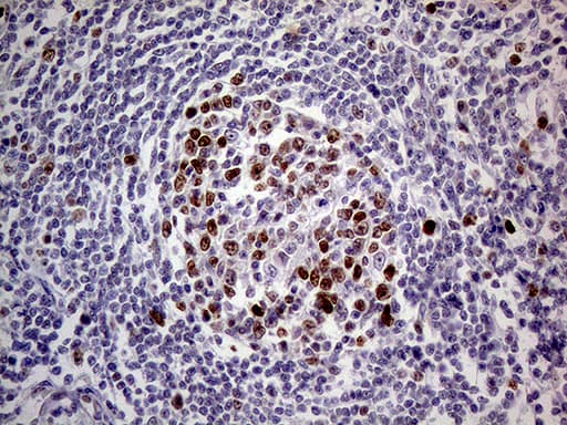 MAGEB4 Antibody (aa1-193, clone OTI1B5)