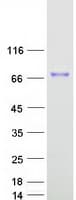 Human CIRH1A Protein (Recombinant Myc-DDK (Flag))