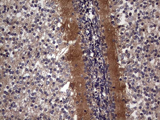 TACC2 Antibody (aa727-1026, clone OTI4F10, Carrier-free)