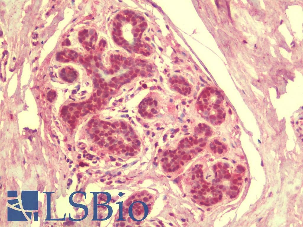 IHC-plus™ SIK3 / QSK Antibody