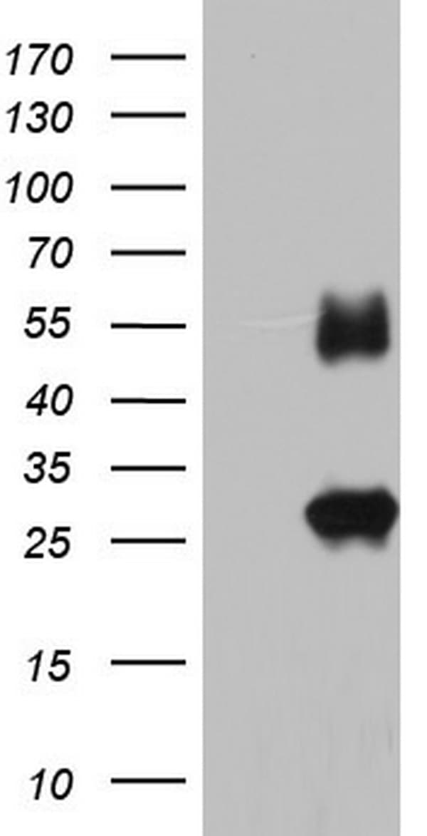 IGSF11 / VSIG3 Antibody (aa23-241, clone OTI1B9)