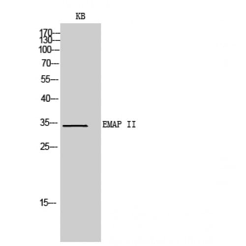 Polyclonal Rabbit anti-Human AIMP1 / EMAP II Antibody (91-140 aa, Internal, WB)