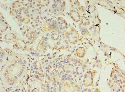 CCDC109B Antibody