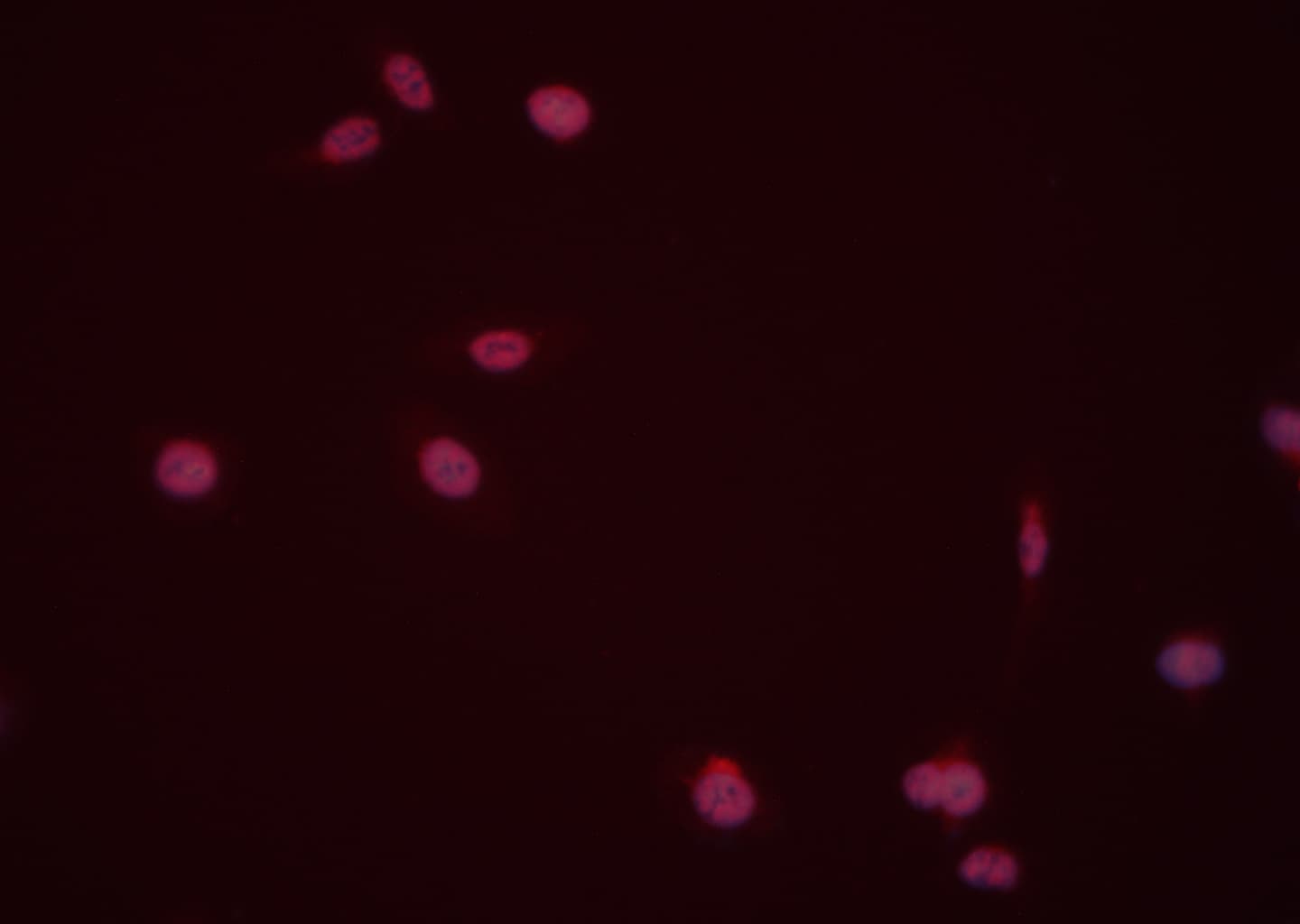 DUSP6 / MKP3 Antibody