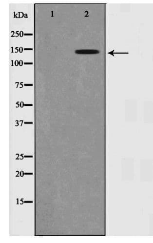 NTRK2 / TRKB Antibody (phospho-Tyr515)