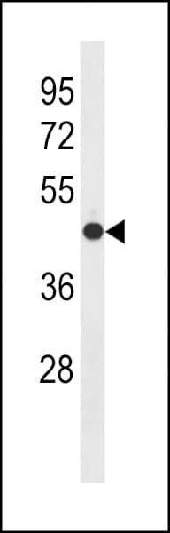OPTIMEDIN / OLFM3 Antibody (aa114-142)