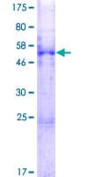 Human MESDC2 / MESD Protein (Recombinant GST)