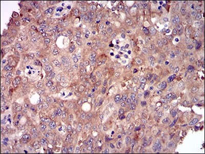 Monoclonal Mouse anti-Human DIS3L2 Antibody (clone 6C7B2, aa27-250, IHC, WB)