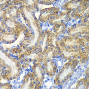 Polyclonal Rabbit anti-Human FAH Antibody (IHC, IF, WB)