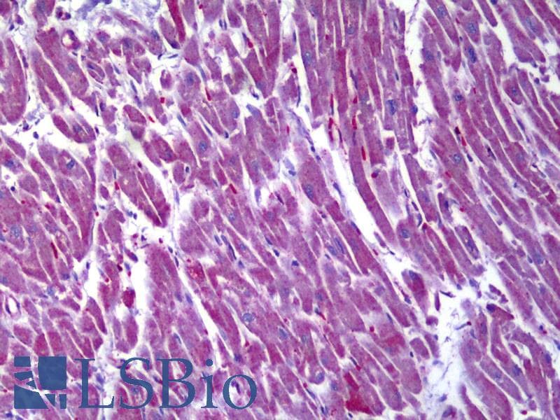 IHC-plus™ Monoclonal Mouse anti-Human MDH / MDH2 Antibody (clone 1G12, IHC, WB)