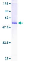 Human GCLM Protein (Recombinant GST)