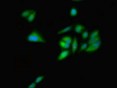 Polyclonal Rabbit anti-Human GNL1 Antibody (WB)
