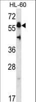 HSF4 Antibody (aa100-128)