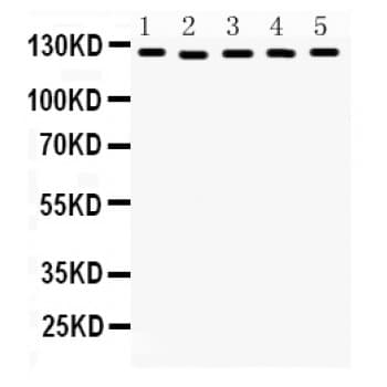 DDB1 Antibody (aa1011-1140)