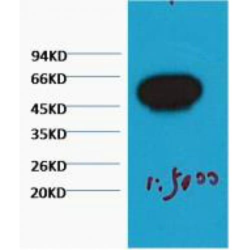Beta Tubulin Antibody (C-term)