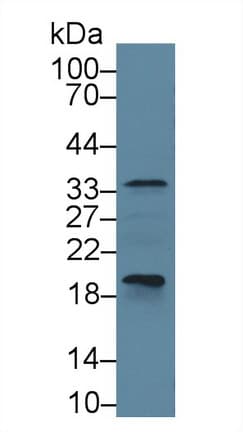 CASP6 / Caspase 6 Antibody (aa194-293)