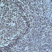 PARP1 Antibody