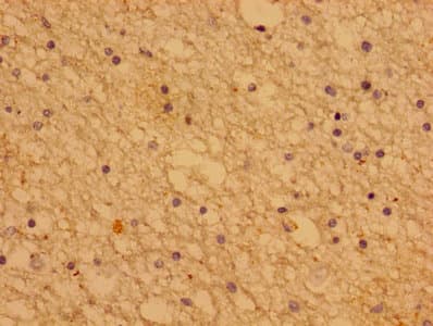 PTHLH / PTHRP Antibody