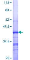 Human TUBA1A / Tubulin Alpha 1a Protein (Recombinant GST, N-terminus)