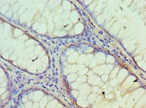 Polyclonal Rabbit anti-Human IDH2 Antibody (aa193-452, IHC, WB)