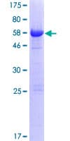Human OGFOD2 Protein (Recombinant GST)