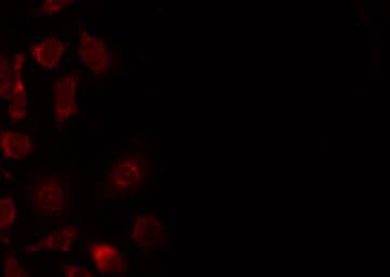SYT1 / Synaptotagmin Antibody (phospho-Ser309)