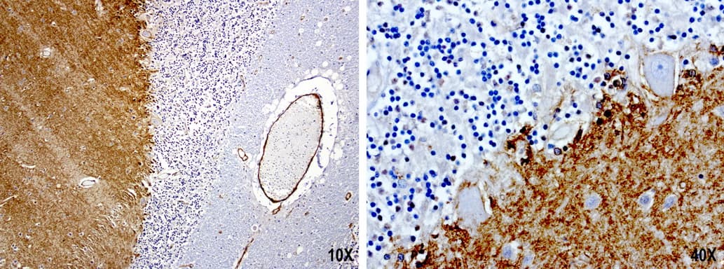 PROCR / EPCR Antibody (aa1-210, clone UMAB200)