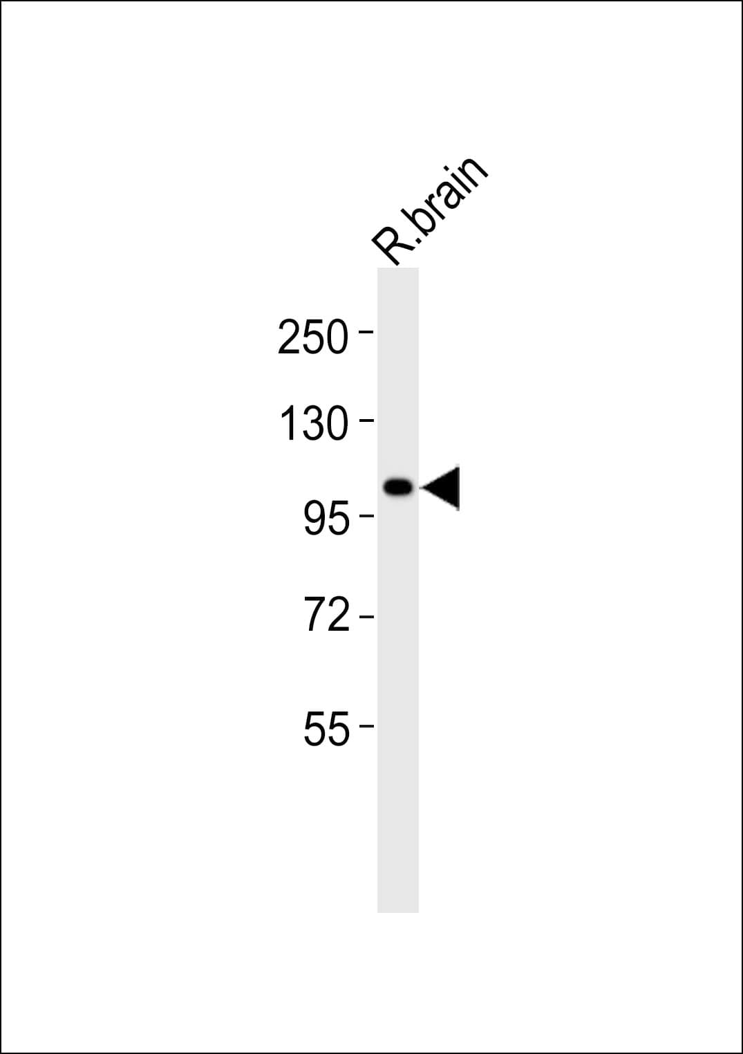 ADGRF1 / GPR110 Antibody