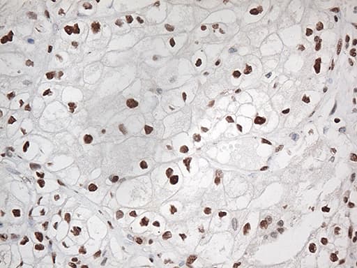 EWSR1 / EWS Antibody (aa256-447, clone OTI2D9, Carrier-free)