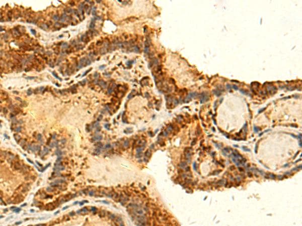 Polyclonal Rabbit anti-Human HS1BP3 Antibody (IHC)