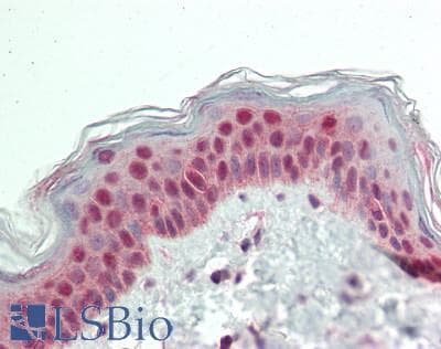 IHC-plus™ Polyclonal Rabbit anti-Human STAT2 Antibody (C-Terminus, IHC, WB)