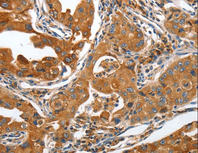 ANAPC10 / APC10 Antibody