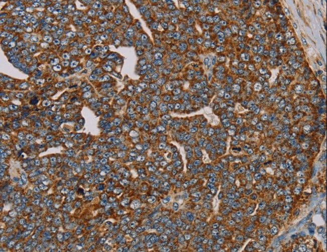MRPL28 Antibody