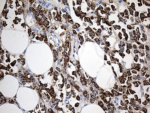 TFF1 / pS2 Antibody (aa25-84, clone OTI5H5)