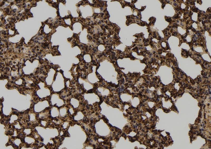 DLD / Diaphorase / E3 Antibody
