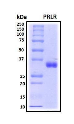 Human PRLR / Prolactin Receptor Protein (Recombinant His, N-Terminal)