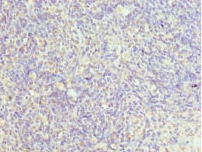 Polyclonal Rabbit anti-Human CHMP2B Antibody (IHC)