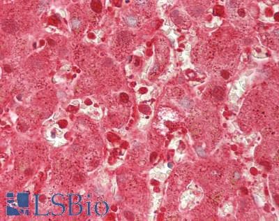 CAT / Catalase Antibody (clone 1B6, Carrier-free)