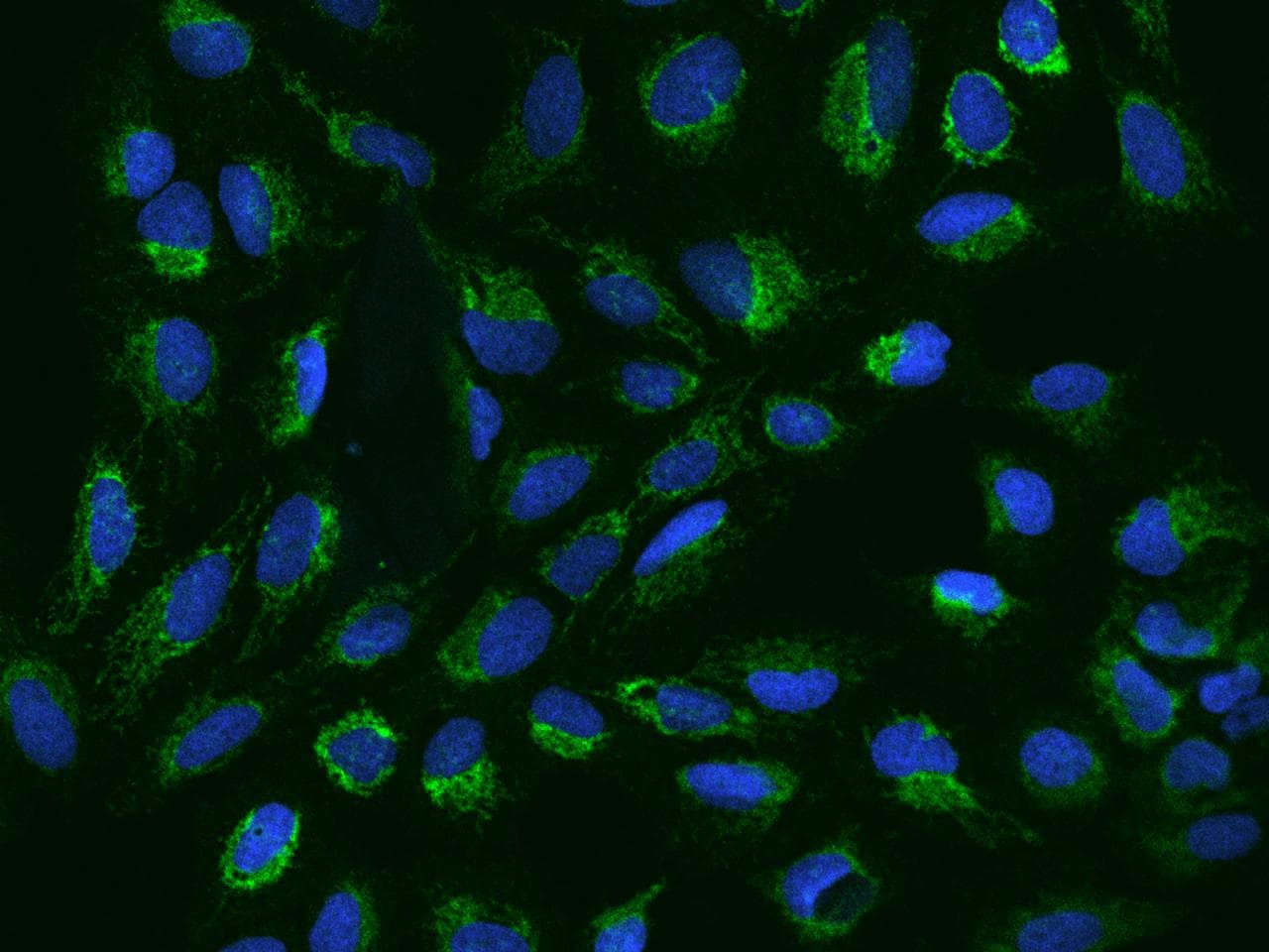 CHCHD5 Antibody